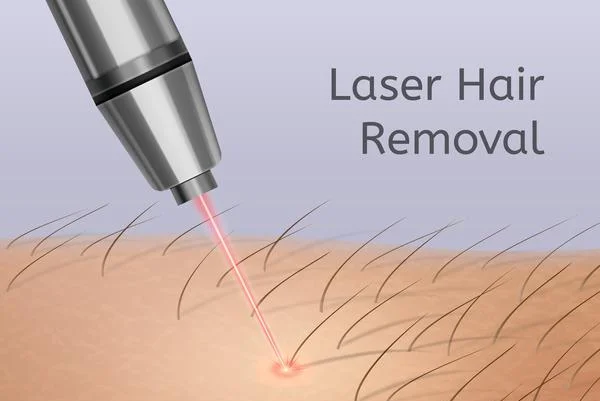 Laser Hair Removal