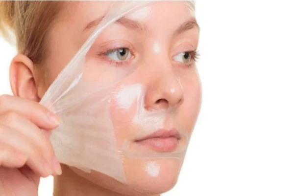 Chemical Peeling