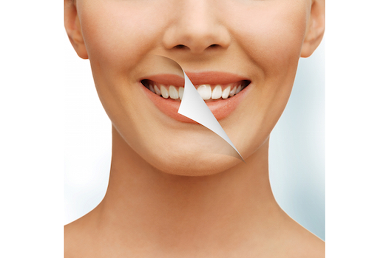 Smile Designing