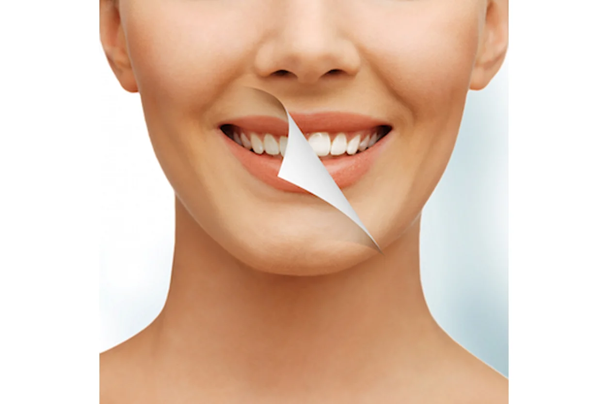 Smile Designing